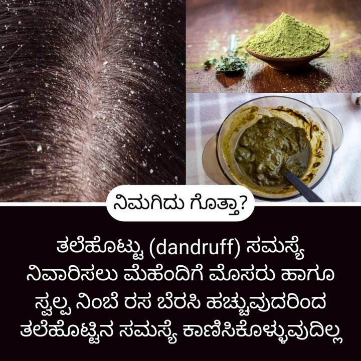 Home Remedies ಮನೆ ಮದ್ದು