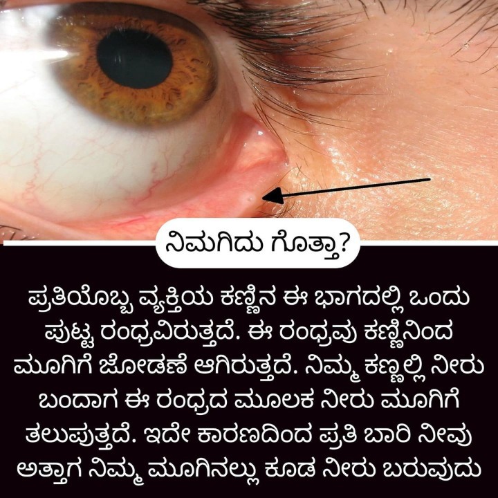 Home Remedies ಮನೆ ಮದ್ದು