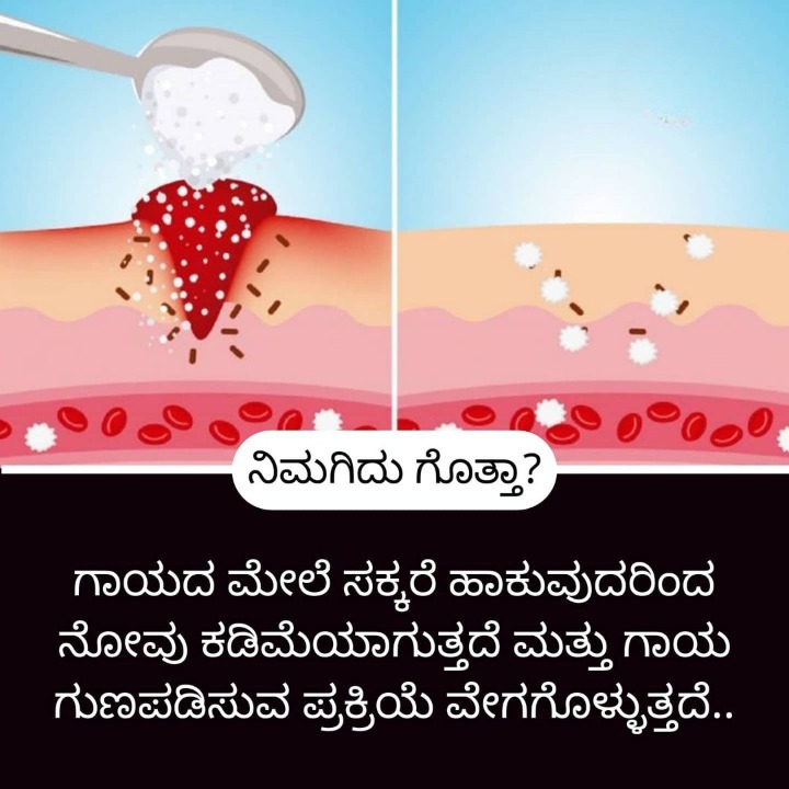 Home Remedies ಮನೆ ಮದ್ದು