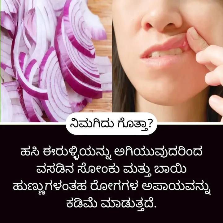 Home Remedies ಮನೆ ಮದ್ದು